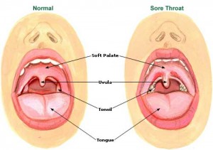 gargling with salt water for a sore throat